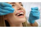 Trusted Dental Implant Experts in Melbourne