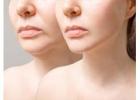 How Can Facial Plastic Surgery Enhance Your Confidence?