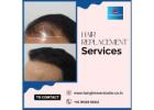 Hair Replacement in Bangalore-Hair Replacement Center