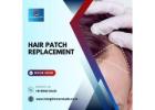 Hair Patch replacement in Bangalore-Hair Patch Repair center