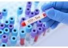 Discreet and Reliable STD Testing Services