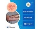 Best Psoriasis Treatment In Rajkot-Vaid Yayogeshvani