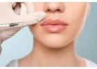 Best Fillers treatment in Richmond Hill