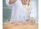 Best Cupping treatment in Soho