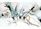 Affordable Minimally Invasive Surgery