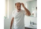 Regain Your Confidence with Expert Hair Restoration for Men in Los Angeles