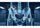 Hip Pain Relief Experts | Trusted Orthopedic Care