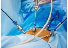 Laparoscopy for Infertility Cost in Delhi - Dr Rhythm Gupta