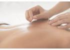 Pain Management Acupuncture in NYC | Back, Neck & Sciatica Relief