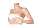 Breast Lift in Delhi - Dr Rajat Gupta