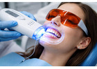 Teeth Whitening in Abbotsford | Professional Smile Brightening