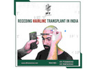 Receding Hairline Transplant in India