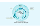 ICSI Treatment in Delhi - Dr Rhythm Gupta