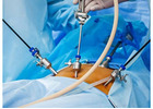 Laparoscopy for Infertility in Delhi - Dr Rhythm Gupta