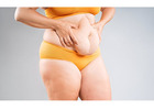 Tummy Tuck Surgery in Delhi - Dr Rajat Gupta