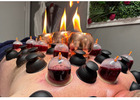 Cupping Therapy NYC | Expert Cupping Services in New York City